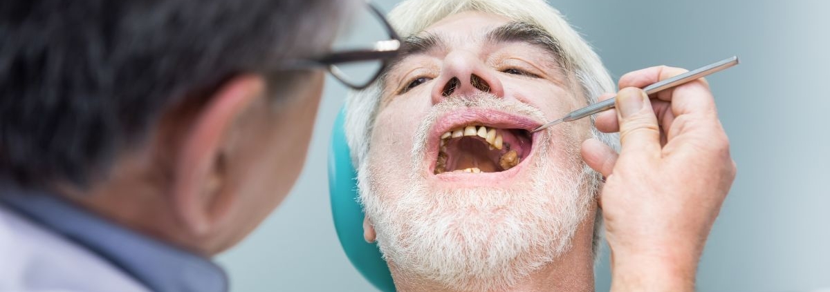 Dentist examining patient's teeth during dental examination in Jacksonville office.